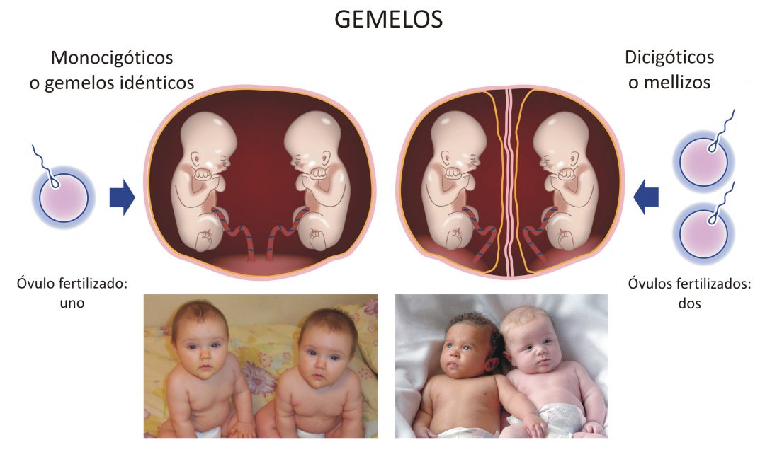 Diferencia entre gemelos y mellizos